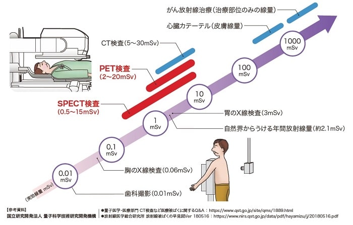 X線検査やCT検査でうける被ばく線量