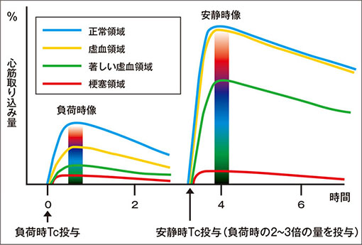 Tc標識製剤の心筋動態の経時的変化(負荷先行の場合) 図