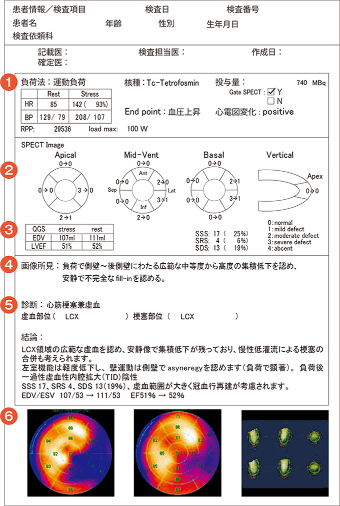 レポートの例