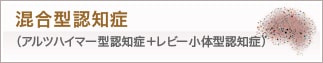 混合型認知症(アルツハイマー型認知症＋レビー小体型認知症)