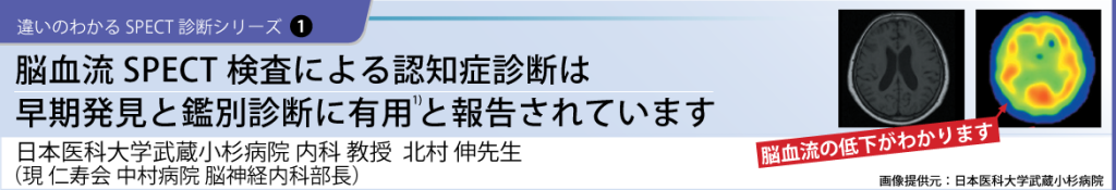 シリーズ1脳血流SPECT検査による認知症診断は早期発見と鑑別診断に有効と報告されています