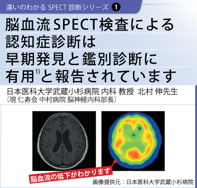 シリーズ1脳血流SPECT検査による認知症診断は早期発見と鑑別診断に有効と報告されています