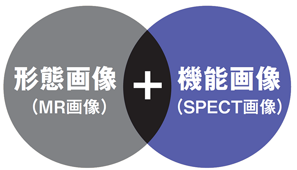 機能画像検査によってさらに有用な情報が得られます