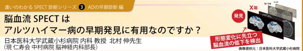 違いのわかるSPECT診断シリーズ 3　ADの早期診断 編