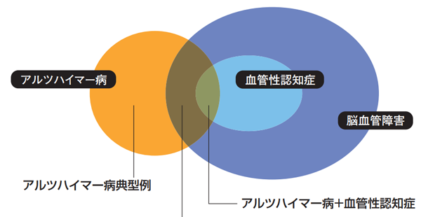 ADと脳血管障害の関係