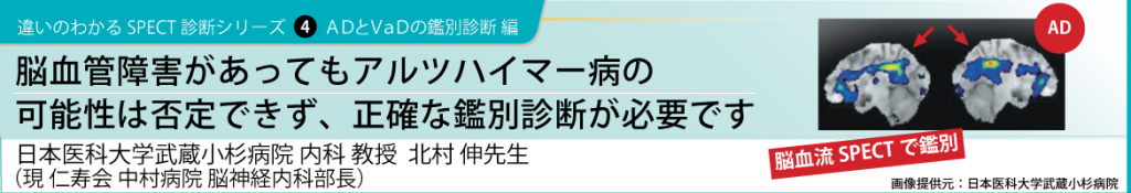 シリーズ4　脳血管障害があってもアルツハイマー病の可能性は否定できず、正確な鑑別診断が必要です