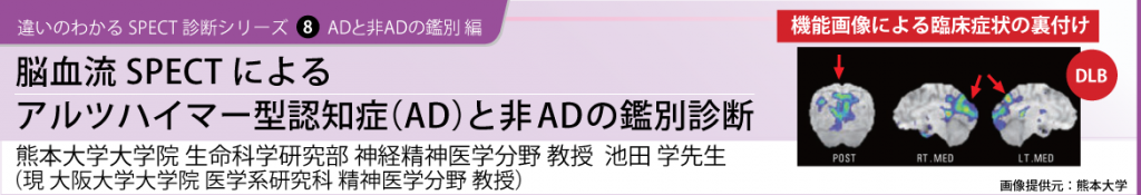 違いのわかるSPECT診断シリーズ 8　ADと非ADの鑑別 編