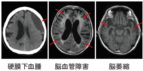 MRI,CT断層画像