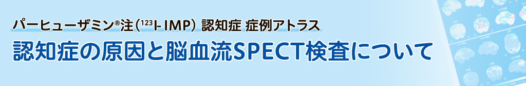 認知症の原因と脳血流SPECT検査について