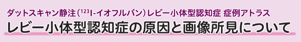 レビー小体型認知症の原因と画像所見について