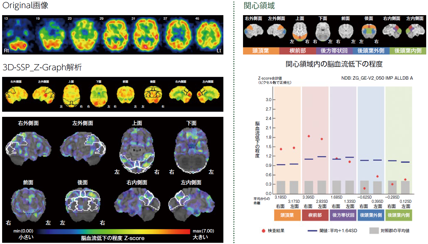 Original画像、3D-SSP_Z-Graph解析、関心領域
