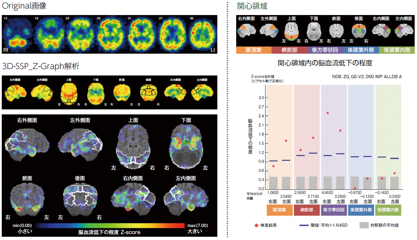 Original画像、3D-SSP_Z-Graph解析、関心領域