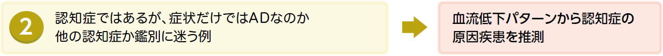 認知症ですあるが、症状だけではADなのか他の認知症か鑑別に迷う例は、血流低下パターンからの認知症の原因疾患を推察
