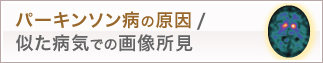 パーキンソン病の原因/似た病気での画像所見