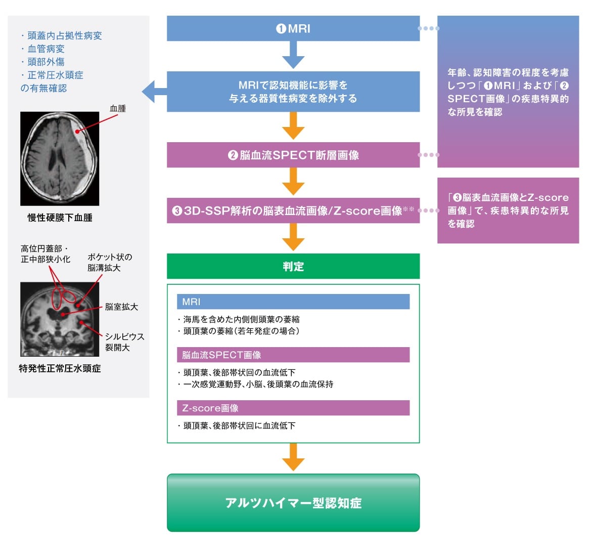 画像診断のフローチャート 問診・診察から認知症／アルツハイマー型  認知症(AD)が疑われた場合