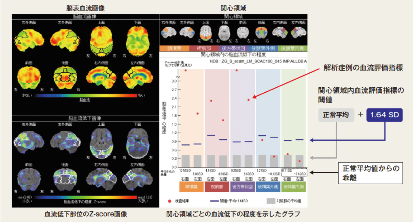 Z-Graph解析画像