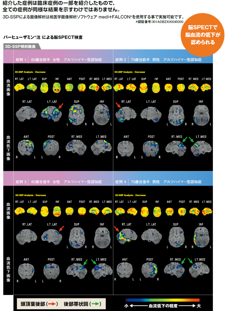 専門医の主な診察の流れと脳SPECT検査
