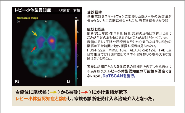 ダットスキャンの場合