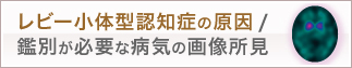 レビー小体型認知症の原因/鑑別が必要な病気の画像所見