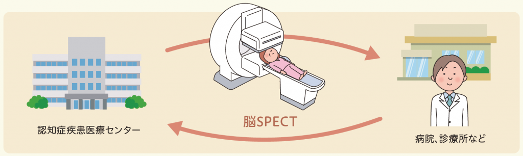 脳SPECT検査と認知症鑑別診断 画像