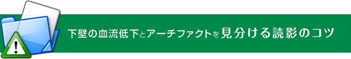 下壁の血流低下とアーチファクトを見分ける読影のコツ