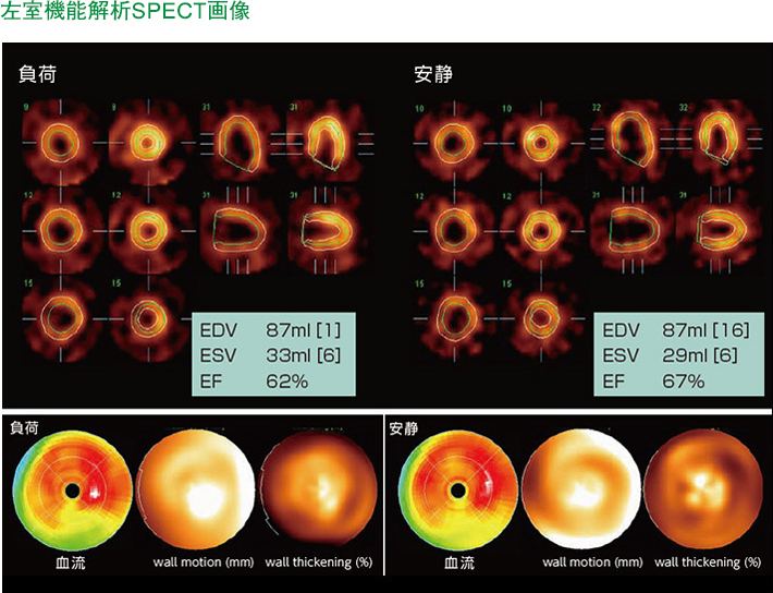 左室機能解析SPECT画像