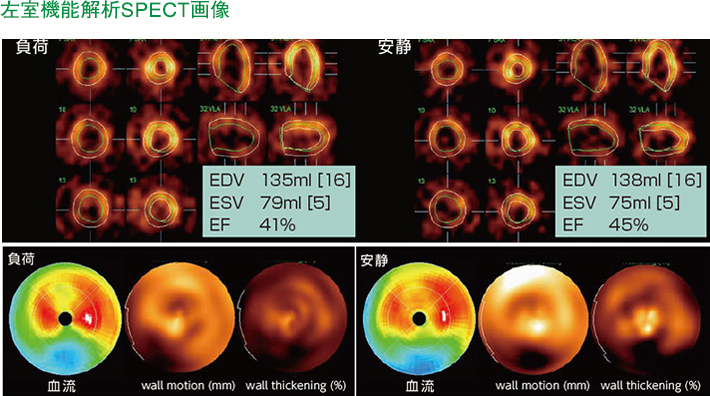 左室機能解析SPECT画像