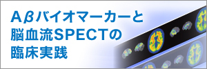 Aβバイオマーカーと脳血流SPECTの臨床実践 資料請求