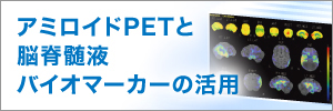 アミロイドPETと脳脊髄液バイオマーカーの活用　資材DL