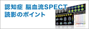 認知症 脳血流SPECT読影のポイント　サムネイル