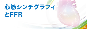 心筋シンチグラフィとFFR