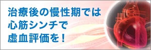 治療後の慢性期では心筋シンチで虚血評価を！　バナー