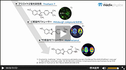 ビザミル静注のご紹介　動画サムネイル