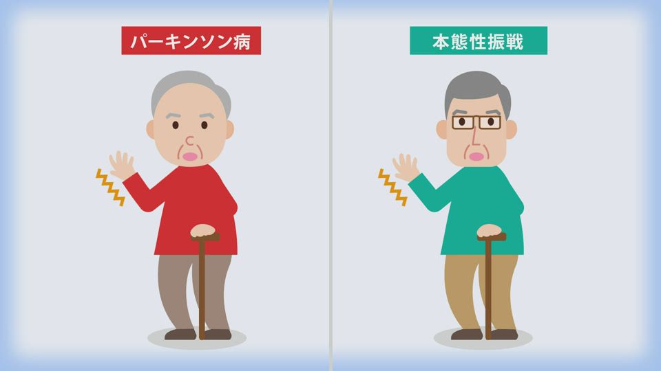 ダットスキャン静注のご紹介　サムネイル