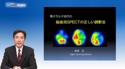 電子カルテ時代の脳血流SPECTの正しい読影法　サムネイル