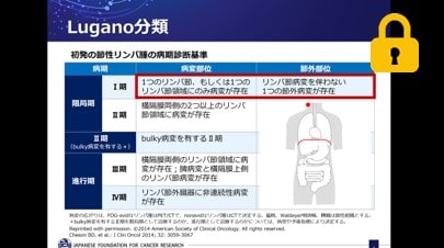 悪性リンパ腫のPET/CT読影　サムネイル