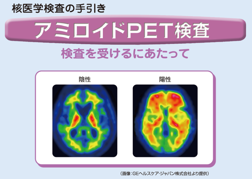 アミロイドPET検査　検査を受けるにあたって