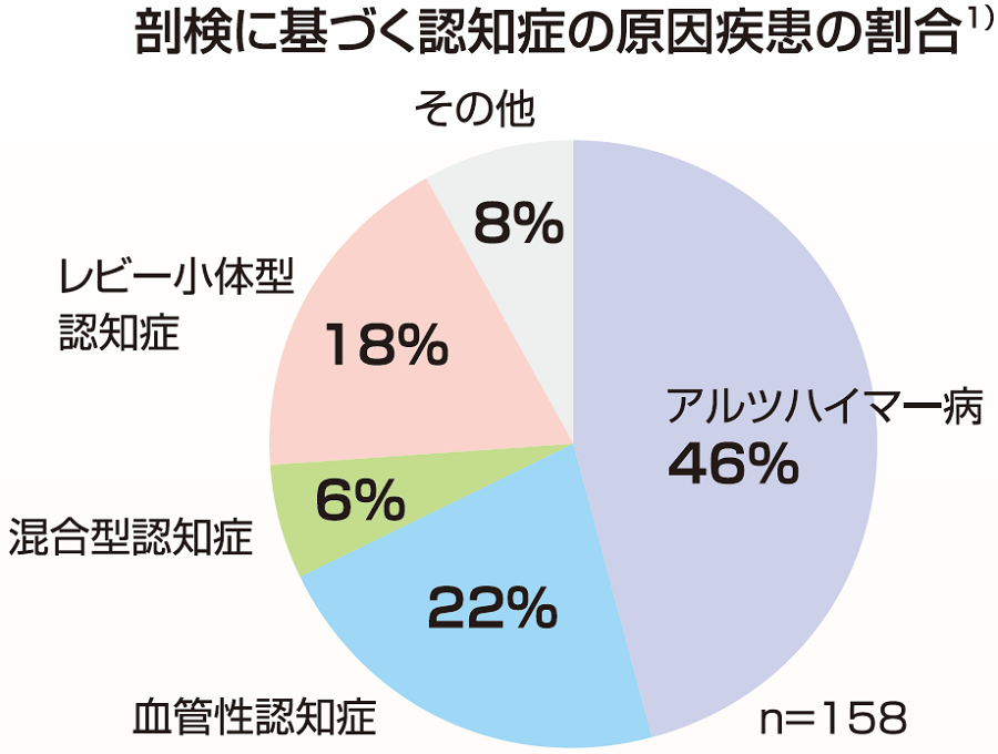 円グラフ