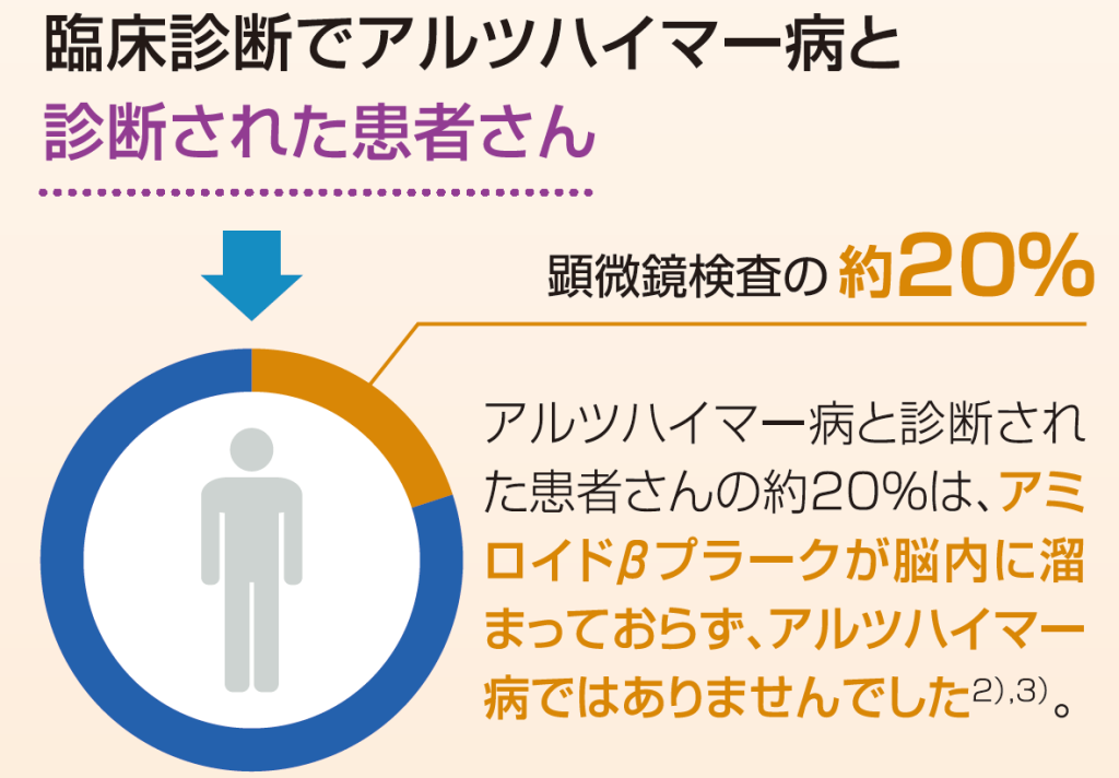 顕微鏡検査でわかったこと