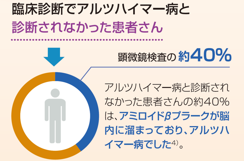 顕微鏡検査でわかったこと