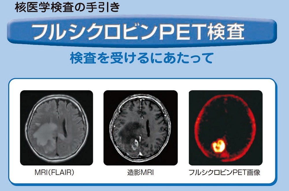 フルシクロビンPET検査 検査を受けるにあたって