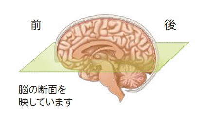 脳のイラスト