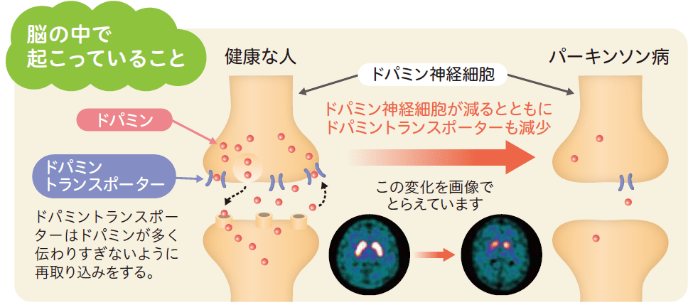 脳の中で起こっていることイラスト解説