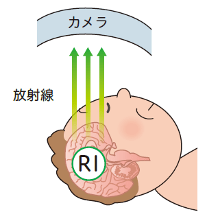 放射性医薬品のイメージ図