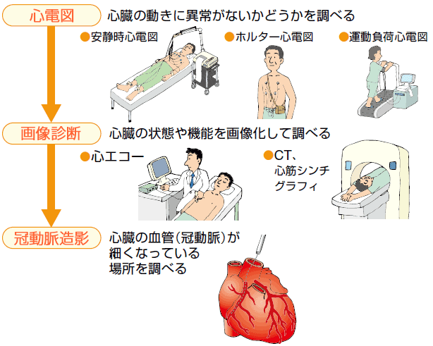 主な検査とそのながれ