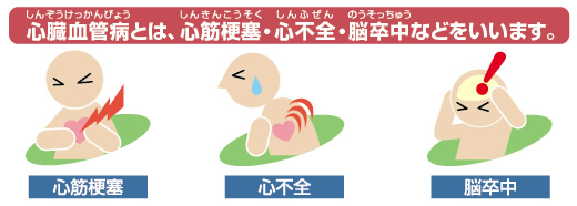 悪く 腎臓 なると が 慢性腎臓病(CKD)とは—腎臓が悪くなると、脳卒中や心筋梗塞のリスクが高まる？