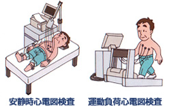 心電図検査、左：安静時心電図検査,右：運動負荷心電図検査
