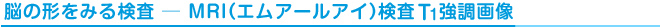 脳の形をみる検査-MRI（エムアールアイ）検査のT1強調画像