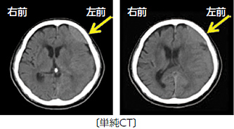 見出し