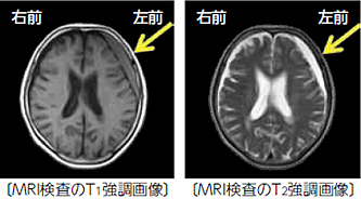 見出し